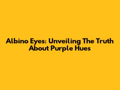 Albino Eyes: Unveiling The Truth About Purple Hues