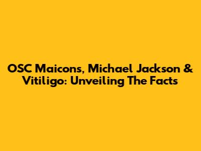 OSC Maicons, Michael Jackson & Vitiligo: Unveiling The Facts