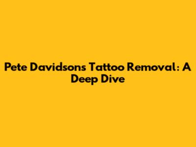 Pete Davidson's Tattoo Removal: A Deep Dive