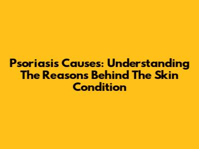 Psoriasis Causes: Understanding The Reasons Behind The Skin Condition
